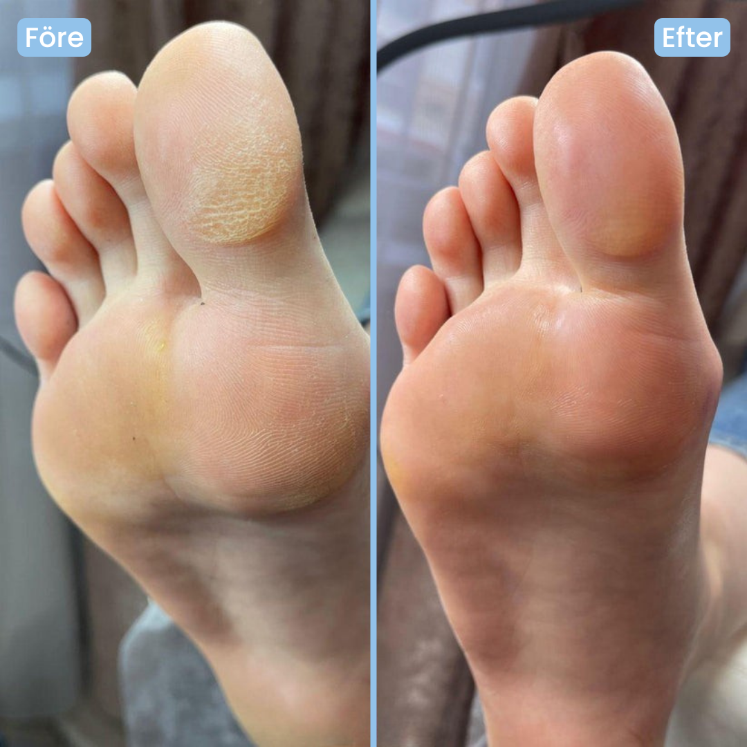 Blissy™ SilkyStep - Elektrisk fotfil